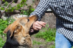 Hand Dog bite 